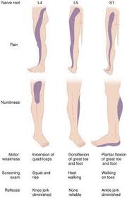 Pin On Lowerback Sciatica Si Joint Pain