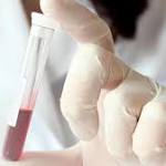  Blood test offers hope of finding cancers before symptoms develop