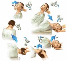 Image result for Canalith Repositioning Procedure