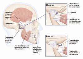 Call him, if you believe you have tmj in greenwood village. Jaw Pain Treatment Sydney Tmj Pain Advanced Care Chiropractic