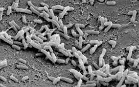Image result for Rhizobium radiobacter, syn. Agrobacterium tumefaciens
