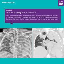 Image result for Air Bronchogram