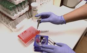 From wikipedia, the free encyclopedia. Malaria Diagnostic Clinic Chimioterapie È™i Prevenire Cum Se Transmite Exact Malaria È™i Cine Este PurtÄƒtorul Ciclul De ViaÈ›Äƒ Al Patogenilor Malariei Umane