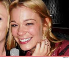 5 Celebrities Who Didn't Have Perfect Teeth