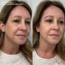 Holly Tabor, MS, APRN, FNP-C