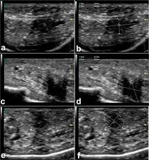 By david derbyshire, environment editor. Ultrasound Detection Of Cosmic Filler Injection Of Lips In Camel Beauty Pageants First Report In Veterinary Medicine Springerlink