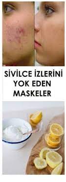 Pin On Cilt Bakimi