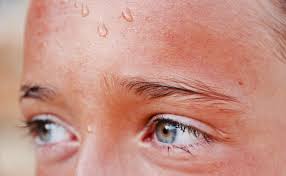 De ce apare transpiratia rece. Hiperhidroza Skinmed Clinic Centrul Dermatoestetic