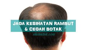 Yang perlu anda buat adalah mendapatkan ubat atau produk. Cara Atasi Rambut Gugur Lelaki Yang Takut Botak Ohcantik Com
