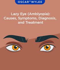 Image result for Amblyopia