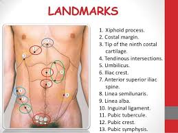 Landmarks 1 Xiphoid Process 2 Costal Margin 3 Tip Of The Ninth Costal Cartilage 4 Ten Medicine Book Anatomy Xiphoid Process