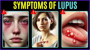 Haydn: Sonata in E-flat Major, Hob.XVI/45, III. Finale, Allegro di molto