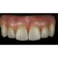 MiYo and Monolithic Zirconia Hybrids event image