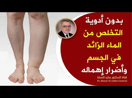 مازن السقا، الجميع يبحث عن كل ما. 15 27 Mb Ø¯ÙˆØ§Ù„ÙŠ Ø§Ù„Ø³Ø§Ù‚ÙŠÙ† ÙˆØ§Ù†ØªÙØ§Ø® Ø§Ù„Ù‚Ø¯Ù…ÙŠÙ† ÙƒÙ†Ø² Ø¬Ø¹Ù„Ù‡ Ø§Ù„Ù„Ù‡ ÙÙŠ Ù‡Ø°Ø§ Ø§Ù„Ø¯ÙˆØ§Ø¡ ÙŠØ´ÙÙŠ Ø§Ù„Ø£ÙˆØ±Ø¯Ø© Ø§Ù„Ø¹Ù†ÙƒØ¨ÙˆØªÙŠØ© Ø¨Ø³Ø±Ø¹Ø© ÙˆØ¨Ø·Ø±Ù‚ Ø·Ø¨ÙŠØ¹ÙŠØ© Download Lagu Mp3 Gratis Mp3 Dragon