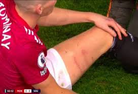 1 day ago • premio. Jankewitz Sent Off After 79 Seconds For Horror Challenge On Mctominay