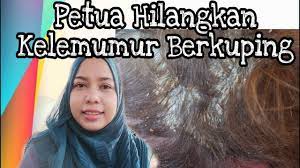 Perah jus limau nipis campurkan jus limau dengan air yang mencukupi sapukan pada rambut biarkan seketika untuk merendam kulit kepala. Cara Menghilangkan Kelemumur Cepat Dandanan 2021