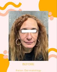 kalon Dermatology (@kalondermatology) • Instagram photos and videos