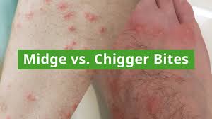 Image result for Chigger