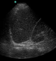 Image result for FAST Exam