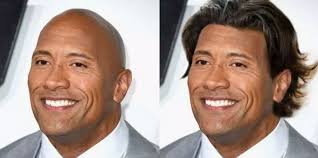 Somebody Added Hair To Bald Celebrities Hair Humor Hair Transplant Surgery Photoshop Celebrities