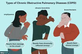 Our color chart features flat design colors. End Stage Copd Symptoms Causes And Coping