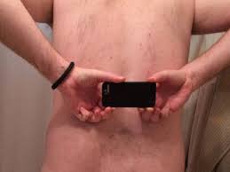 Man with no butt crack opens up about his bizarre - and painful - condition  - Mirror Online