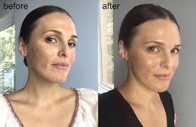 Is vitamin c serum good for wrinkles? The Secret Of Vitamin C Serum Programming Insider