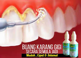 Seseorang akan mudah terkena iritasi dan peradangan jika terus dibiarkan. Teeth Whitening Pemutih Gigi Tanggalkan Karang Gigi 30 Gram Herbal Tooth Powder Lazada