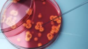 Drug-Resistant ‘Superbug’ Confirmed in 23 States: Should You Worry?