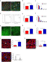 re enforcing hypoxia induced polyploid cardiomyocytes enter