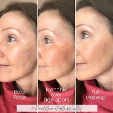 how to cover up Xanthelasma?