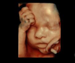 Hello! My name is Savannah I just recently graduated high school back in a  June 2024 and I am in my first year of college to become an ultrasound for  fetal ultrasound.