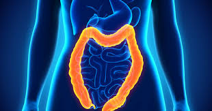 Moins il est avancé, meilleures sont les chances de survie et de guérison. Cancer Du Colon Cancer Colorectal Symptomes Personnes Et Facteurs De Risque