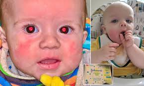 Prime minister of the united kingdom and leader of the conservative party. Johnson And Johnson Launch Investigation After Mothers Claim Children Were Left With Burn Marks Daily Mail Online