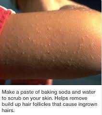 Get Rid Of Those Bumps On Your Arms And Legs Skin Care Solutions Body Skin Care Ingrown Hair