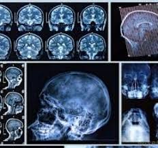 Pagina demonstrativa afacerea nu este promovata iar locul este liber. Medic Radiolog Imagistica Drobeta Turnu Severin Investigatii Rmn Ct Tomografie Computerizata