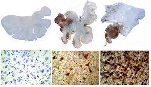 Find perkins funding information, state career and technical education (cte) enrollment and performance reports, data downloads, and state contact information. About Cte Alzheimer S Disease Center Boston University