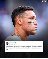 Aaron Judge has a flexor strain and will be going