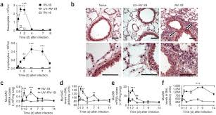 This is a most commonly occurring viral infection, affecting people. Mouse Models Of Rhinovirus Induced Disease And Exacerbation Of Allergic Airway Inflammation Nature Medicine