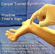 Diagnosis And Testing For Carpal Tunnel Syndrome - Portland Hand Surgery