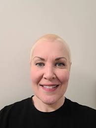 Nicely done and welcome to the bleached buzz cut club