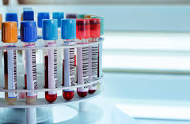 Une fatigue par exemple ne justifie pas systématiquement d'une prise de sang en. Que Peut On Voir Ou Ne Pas Voir Dans Une Prise De Sang Clinique Veterinaire Des Pres Hauts