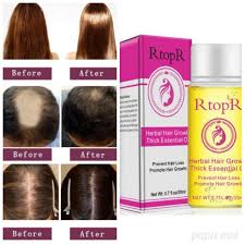 Sage oil may also be useful in the event that you suffer from curled, unmanageable hair. Rtopr Herbal Hair Growth Thick Essential Oil Shopee Philippines