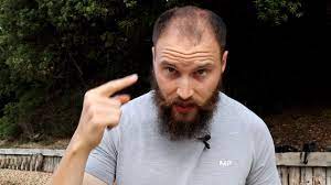 Kobebryant (black mamba, kb24, vino, showboat, little flying warrior, the eighth man) position: This Guy Grew Out His Balding Hair And Says It Changed His Life