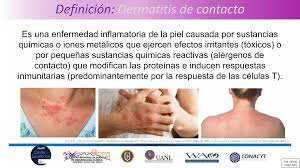 Image result for dermatitis contacta toxica