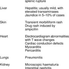 Kaye инфекционный мононуклеоз // справочники msd. Pdf Infectious Mononucleosis And Epstein Barr Virus