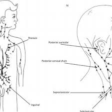 Then two lymphatic trunks will be formed, right and left jugular lymphatic trunks. Pdf Lymphadenopathy In Children Refer Or Reassure