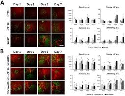 IJMS | Free Full-Text | Expression of EMT-Related Genes in Hybrid E/M  Colorectal Cancer Cells Determines Fibroblast Activation and Collagen  Remodeling