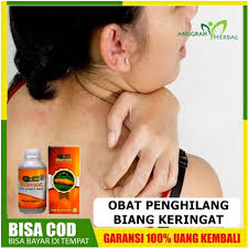 Adakah solusi untuk masalah kayak ini?.punya keluhan penyakit kulit gatal belum sembuh atau sering kambuh?jangan putus asa atau stres. Obat Penghilang Biang Keringat Untuk Anak Dewasa Perih Panas Gatal Kulit Kering Qnc Jelly Gamat Shopee Indonesia