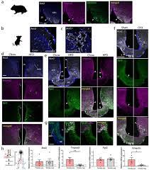 Hamsters are famous for running endless. The Hypothalamus As A Hub For Putative Sars Cov 2 Brain Infection Biorxiv